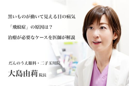 黒いものが動いて見える目の病気「飛蚊症」の原因は？治療が必要なケースを医師が解説